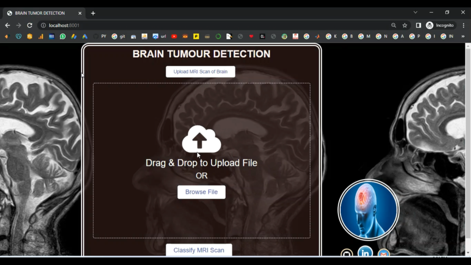 Brain Tumor CNN Image Segmentation in Python Projects