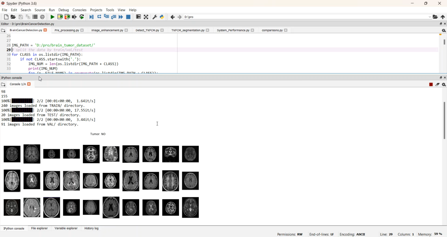 Brain Tumor Segmentation Using Simple CNN Console in Python Projects